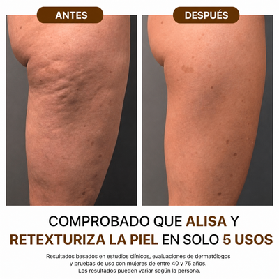 Nura® - Aceite corporal de seda