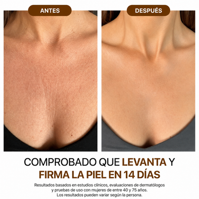 Nura® - Aceite corporal de seda