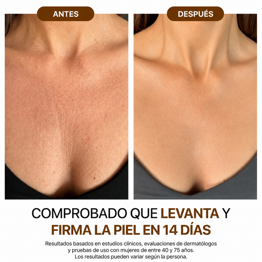 Nura® - Aceite corporal de seda